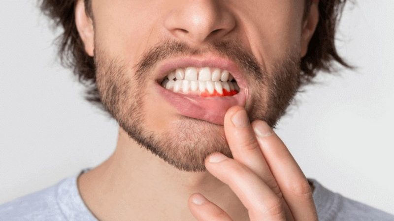 Qu’est-ce que la parodontologie ?