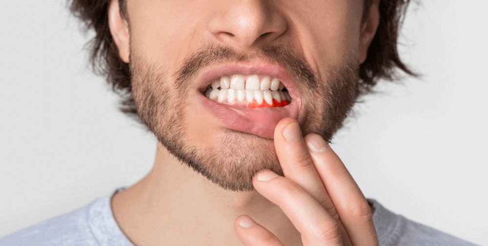 Qu’est-ce que la parodontologie ?