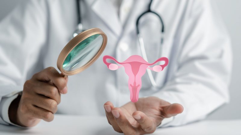 Cancer de l’ovaire, une pathologie facile à diagnostiquer